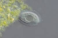 Protozoaire cilié de la panse d'un ruminant (Vache) x100
